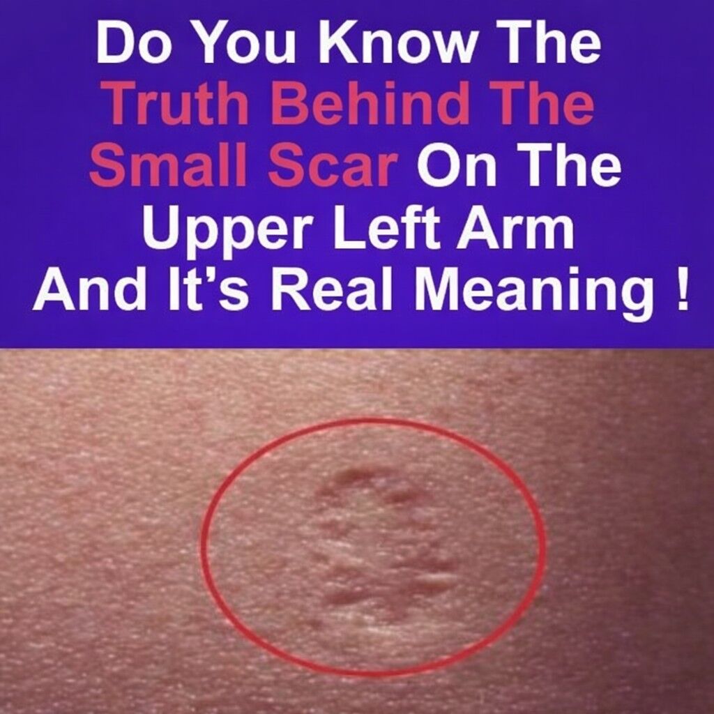 Do you have a circular mark on your arm? This reveals a historical detail that few people know