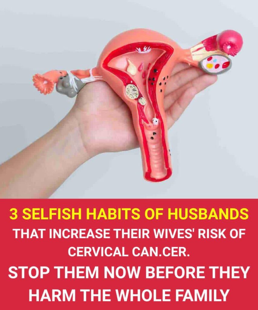 Selfish Habits of Husbands That Increase Their Wives’ Risk of Cervical Can.cer – Stop Them Now Before They Harm the Whole Family