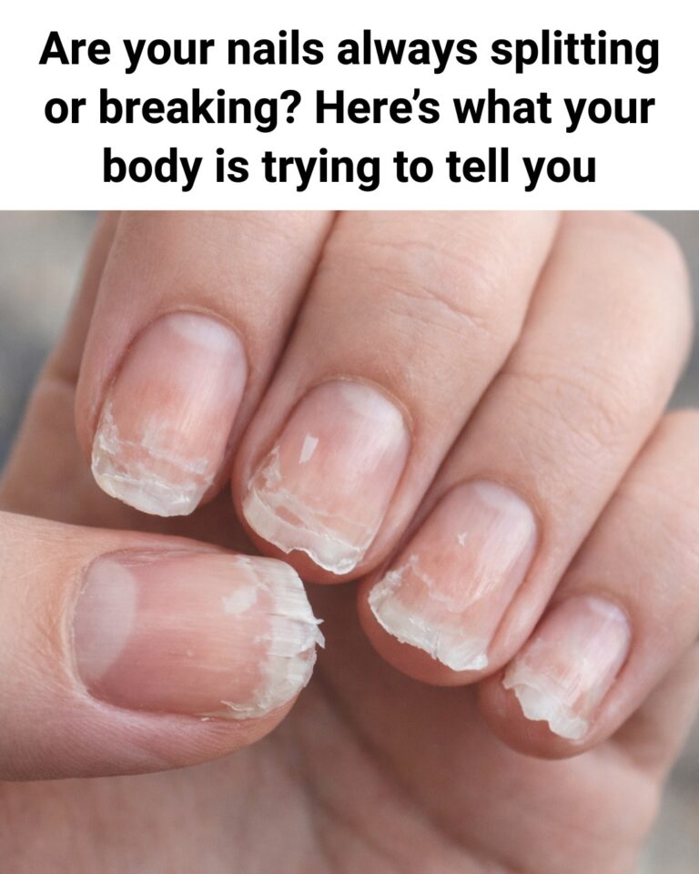 nail-split