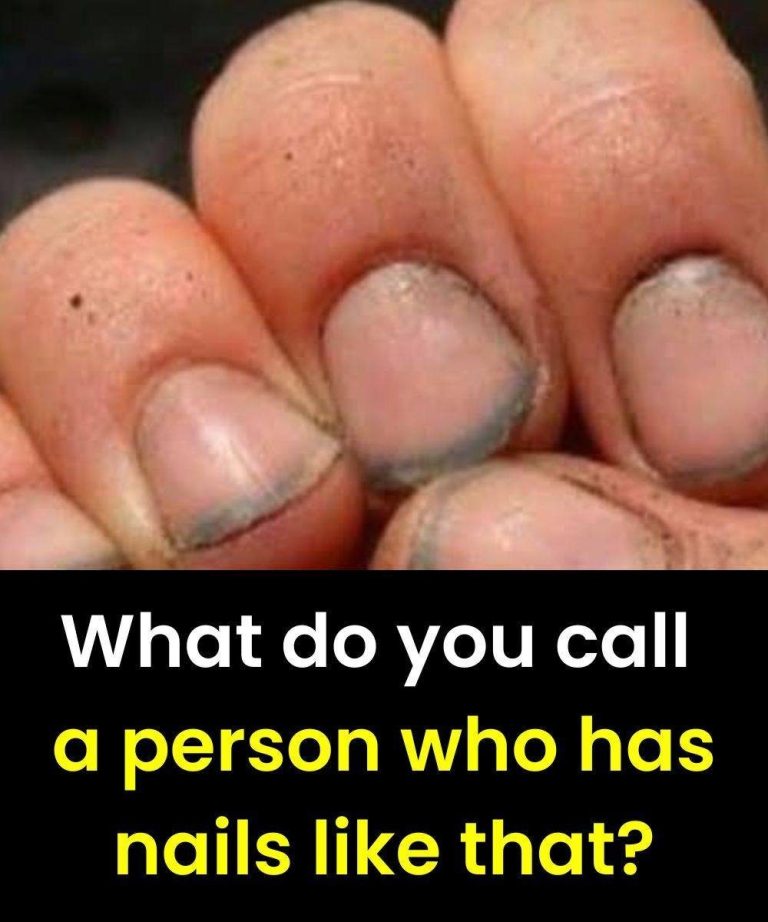 nails-hygiene nails-hygiene